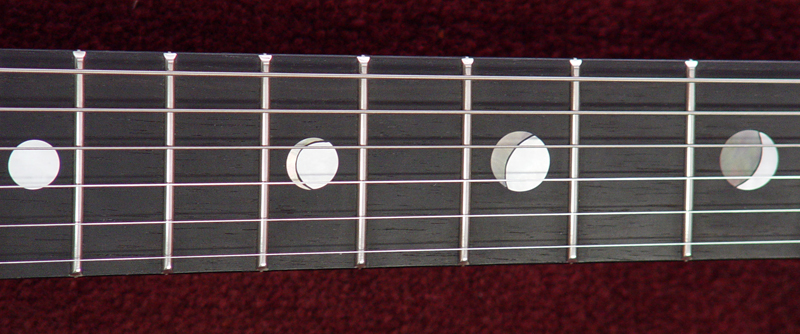 inlays